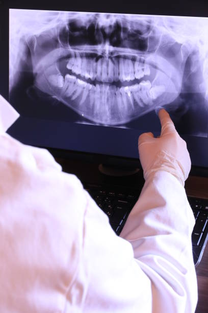 Best Emergency Dental Extractions in Griggsvle, IL