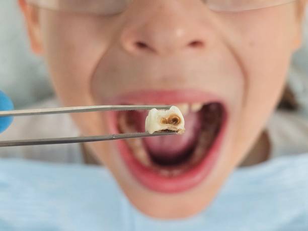 Best Emergency Dentist for Special Needs Patients in Griggsvle, IL