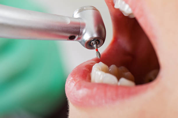 Best Pediatric Emergency Dentist in Griggsvle, IL